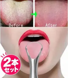 2本セット　口腔ケア✨ 舌クリーナー 舌リムーバー ステンレス製　口臭予防