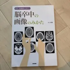 症状・経過観察に役立つ 脳卒中の画像のみかた