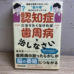 認知症になりたくなければ歯周病を治しなさい