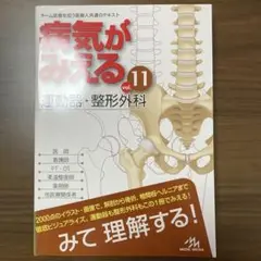 【大特価】病気がみえるvol.11運動器・整形外科