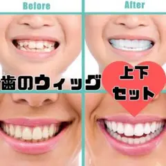 ●マウスピース 矯正 つけ歯 入れ歯 ホワイトニング 義歯 オーラルケア  かぶ