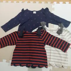 プティマイントップス3点セット