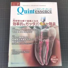 クインテッセンス　2024年7月号　効率的なガッタパーチャ除去