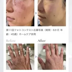 2026年最新】ダーマペン美容液の人気アイテム - メルカリ