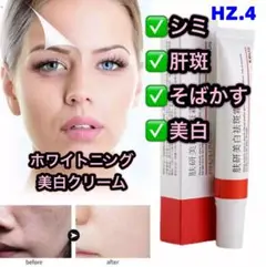 HZ.4EBUG 研美白斑霜　シミ・肝斑・そばかす　美白クリー08y