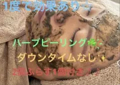 ハーブピーリング 3個