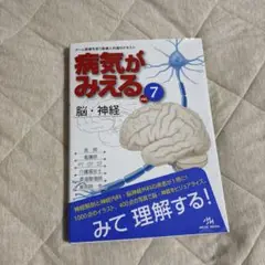 病気がみえる　脳・神経