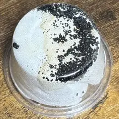 【胆石】