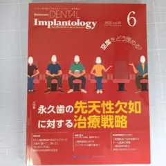 クインテッセンス・デンタル・インプラントロジー　2025-6　永久歯の先天性欠如