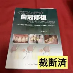 【裁断済】イラストレイテッド歯冠修復アドバンステクニック : ハンズオンで学ぶ イラストレイテッド 歯冠修復 アドバンステクニック - メルカリ