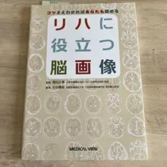 リハに役立つ脳画像 = Brain Imaging Useful for Re…