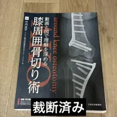 【裁断済】膝周囲骨切り術(AKO)
