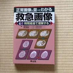 正常画像と並べてわかる救急画像 時間経過で理解する