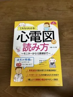 心電図の読み方