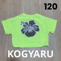 KOGYARU 120 バースデイ Tシャツ ネオン イエロー ハイビスカス