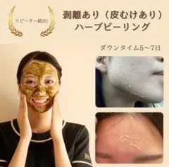 剥離ありハーブピーリング2回分