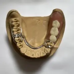 総入れ歯　歯科　入れ歯　フルデンチャー　模型　上顎　下顎　洗ってみました Amazon.co.jp: 歯科 総義歯 金属床 サンプル 模型 見本 入れ歯