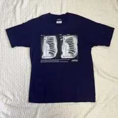ciatre ネイビー X線プリント Tシャツ XS