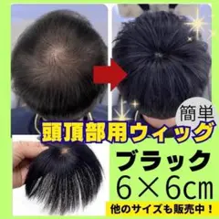 ウィッグ　かつら　6㎝　頭頂部 男　つむじ　メンズ　カバー　簡単　薄毛　42
