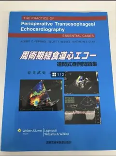 2025年最新】経食道心エコーの人気アイテム - メルカリ