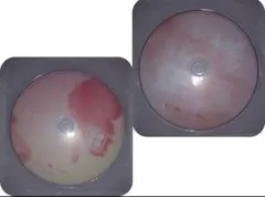 ①【CDのみ】BTS 花様年華 pt.1＆pt.2