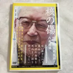 核の傷　肥田舜太郎医師と内部被曝　サンプル盤DVD