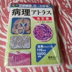 精巣腫瘍病理アトラス 裁断済み 精巣腫瘍病理アトラス 裁断済み 精巣腫瘍病理アトラス 裁断済み