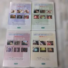 미개봉 CD-ROM 眼科診療のポイント 眼が赤いⅠ～Ⅳ