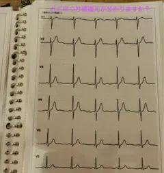心電図検定 健康・医学