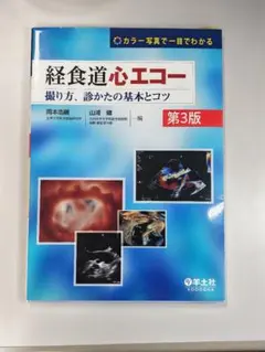 経食道心エコー 撮り方、診かたの基本とコツ 第3版