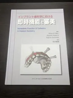 がちゃさん専用　インプラント裏技帖と大技帖50 柴原清隆 インプラント裏技帖50| 歯科総合出版社 デンタルダイヤモンド社
