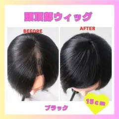 頭頂部ウィッグ　薄毛　脱毛　抜毛　パッチンどめ　1027 ポイントウィッグ