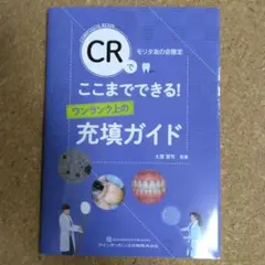 【超美品】CRでここまでできる!充填ガイド