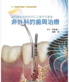 非外科的歯周治療