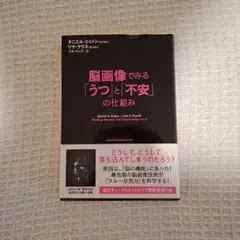 脳画像でみる「うつ」と「不安」の仕組み