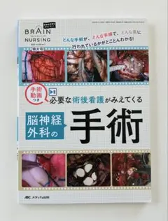 ブレインナーシング
