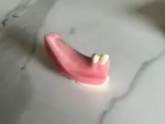 NISSIN DENTAL MODEL T6-IMP.6 個人トレー上下顎セット - メルカリ