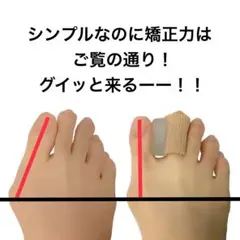 2個入り　親指特化型外反母趾サポーターのサムネイル