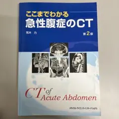2026年最新】ここまでわかる急性腹症のCT 第3版の人気アイテム - メルカリ