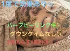 ハーブピーリング3回分(限定3名様
