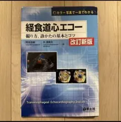 2025年最新】経食道心エコーの人気アイテム - メルカリ