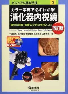 カラー写真で必ずわかる! 消化器内視鏡 改訂版