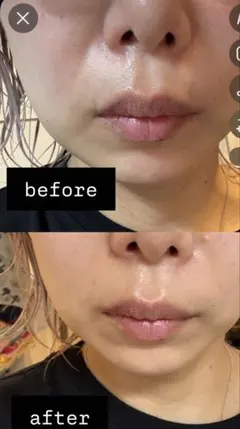 ELFACE 美顔器 ホワイト・ゴールド　ems 美顔器　美顔器