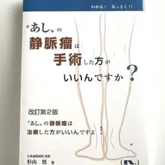 あしの静脈瘤は手術した方がいいんですか 改訂第2版