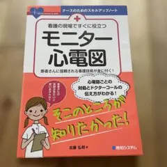 看護の現場ですぐに役立つ モニター心電図
