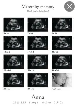 エコー写真 記念フォトプリント作成 オーダーメイド