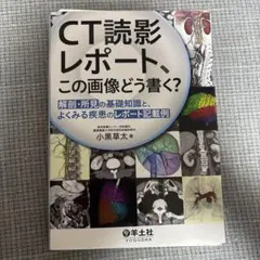 【裁断済】 CT読影レポート、この画像どう書く?