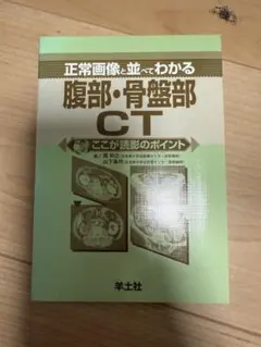 腹部・骨盤部 CT
