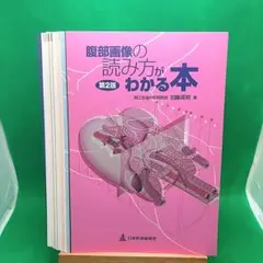 재단 완료 복부 이미지를 읽는 방법을 알 수있는 책 제2판