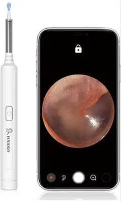 耳かきカメラ 耳掃除 スコープ 3.9mm極細レンズ 1296P画質500万画素